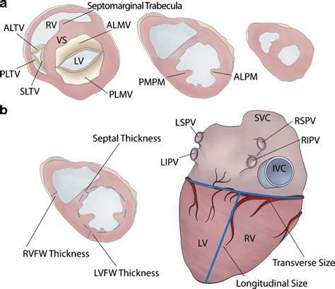 Left Ventricular Mid